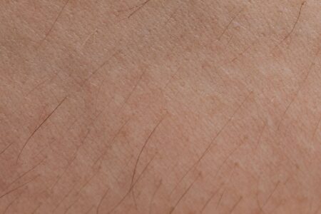 Close-up of bare skin texture illustrating concerns about injectable tanning peptides